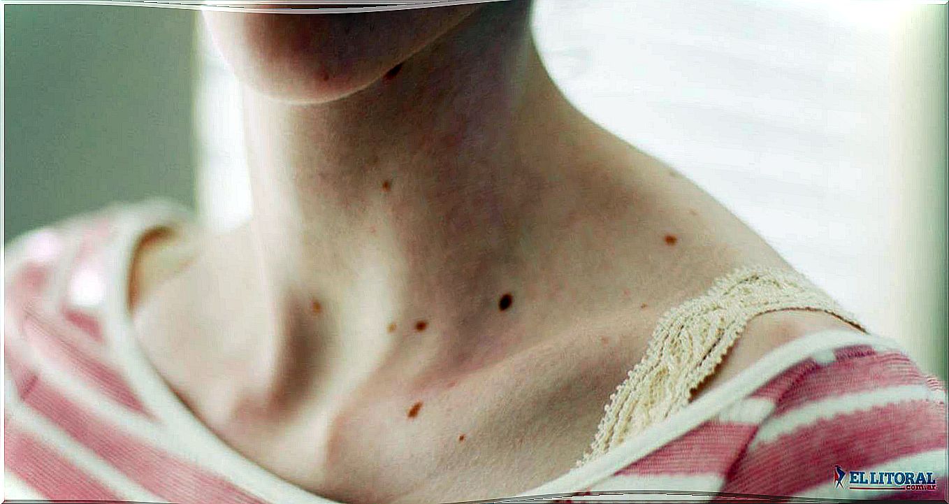 red-dots-skin