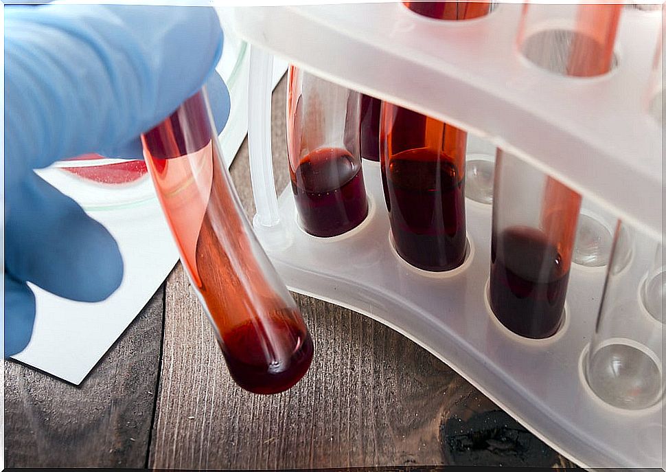 A blood test helps detect cancer in its early stage