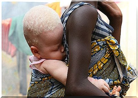 albinos-tanzania-3