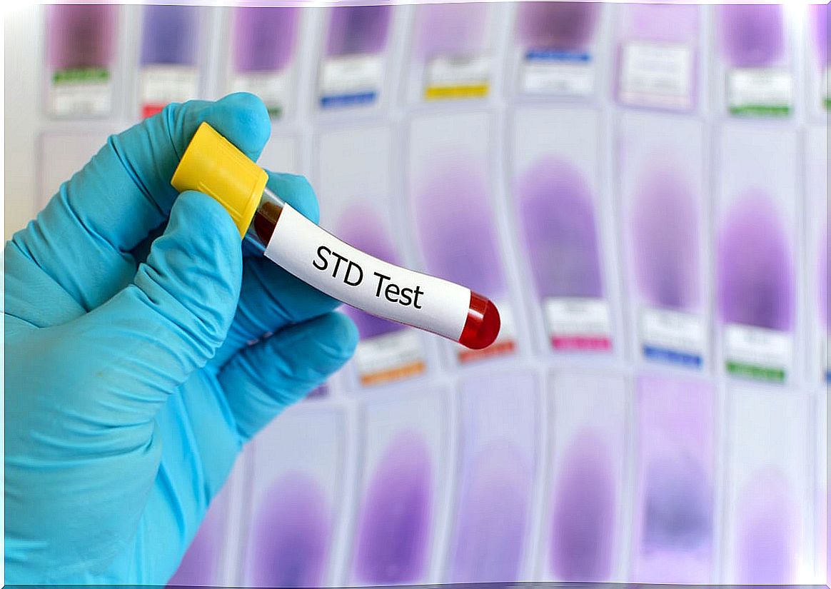 Blood test for STIs
