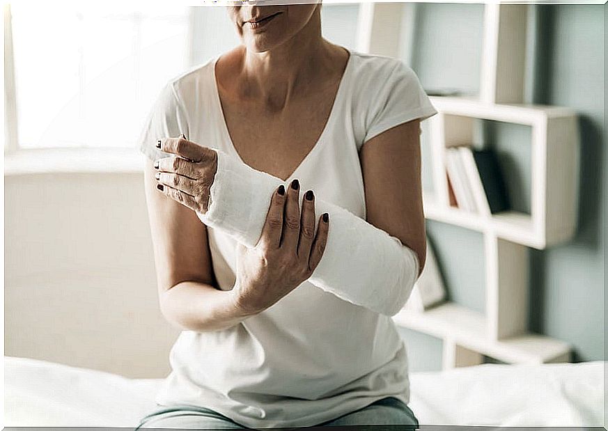 Woman with arm in a cast.
